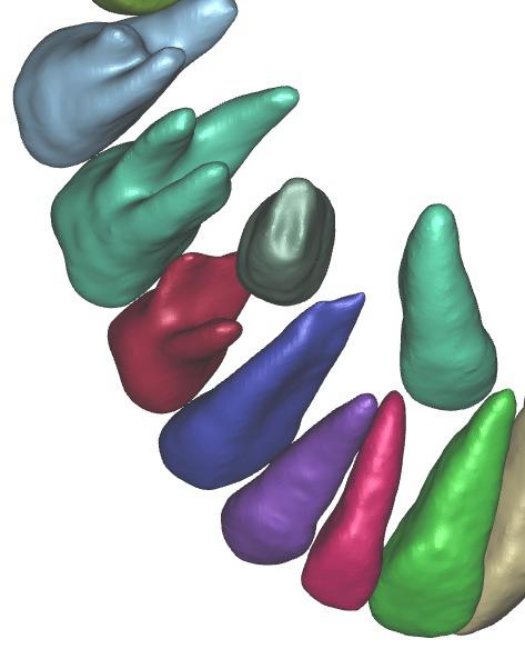 Close detail of a digitally mapped tooth model, each tooth individually segmented and colour coded. Every retainer starts from a scan like this one.